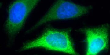 Вчені навчилися повертати старим тканинам регенерацію молодих клітин