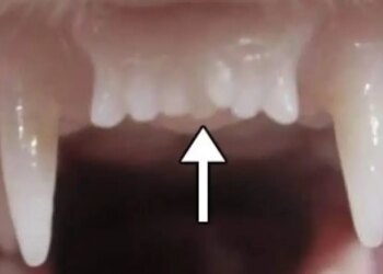 Розпочато клінічні випробування препарату для регенерації зубів у людини