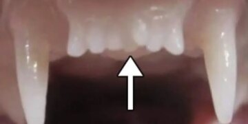 Розпочато клінічні випробування препарату для регенерації зубів у людини