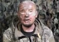 Окупант у полоні вилікувався та змінився до невпізнання
