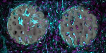 Вчені розробили гідрогель для регенерації кісткової тканини