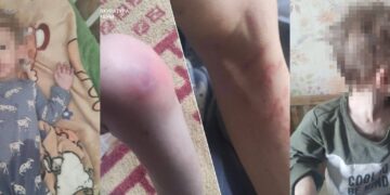 Діти серед бруду і голоду: шокуючі умови життя викрили на Київщині