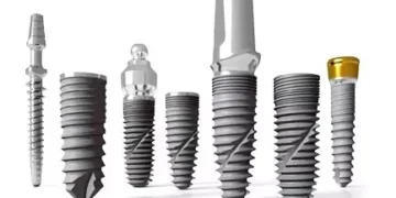 Імплантація All-on-4 – швидкий і доступний спосіб відновлення зубів