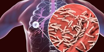 Вчені закликають до інноваційних стратегій боротьби з поширенням туберкульозу