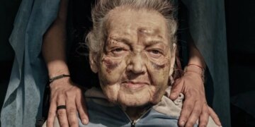 Пережила Другу світову: 89-річна вчителька втратила житло під час обстрілу Києва