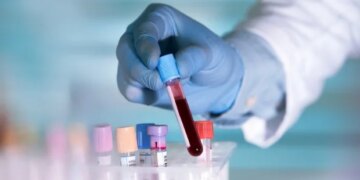 Вчені знайшли спосіб оцінити вік органів за аналізом крові