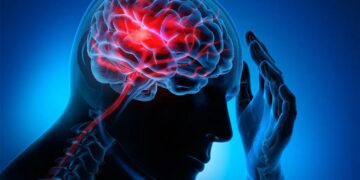 Інсульти серед молодих майже подвоїлися: лікарі досі не знають, що відбувається