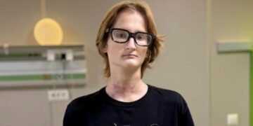У столичному Охматдиті врятували 16-річного хлопця, який на мотоциклі врізався у трос антидронової сітки